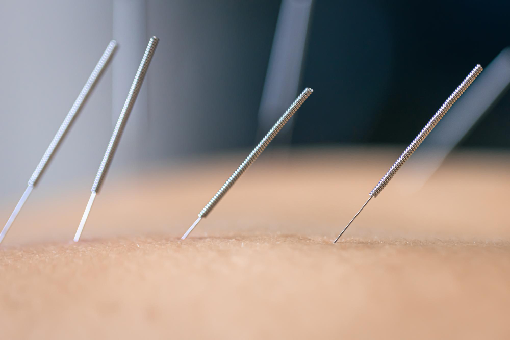 Acupuncture  Littleton, CO